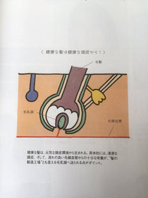 トリートメントの説明